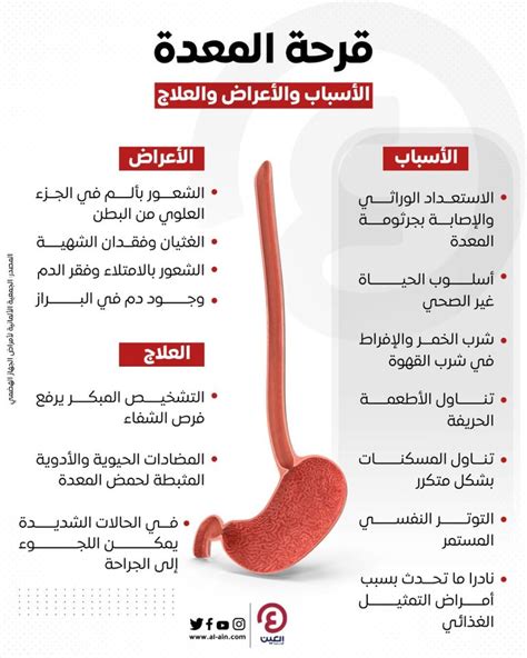 أطعمة ومواد غذائية تسبب قرحة المعدة – ..تعرف على الخبر